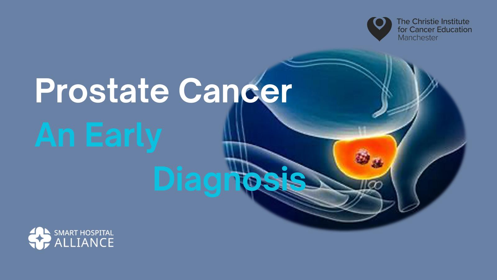 PROSTATE  CANCER: An Early Diagnosis SHA_07