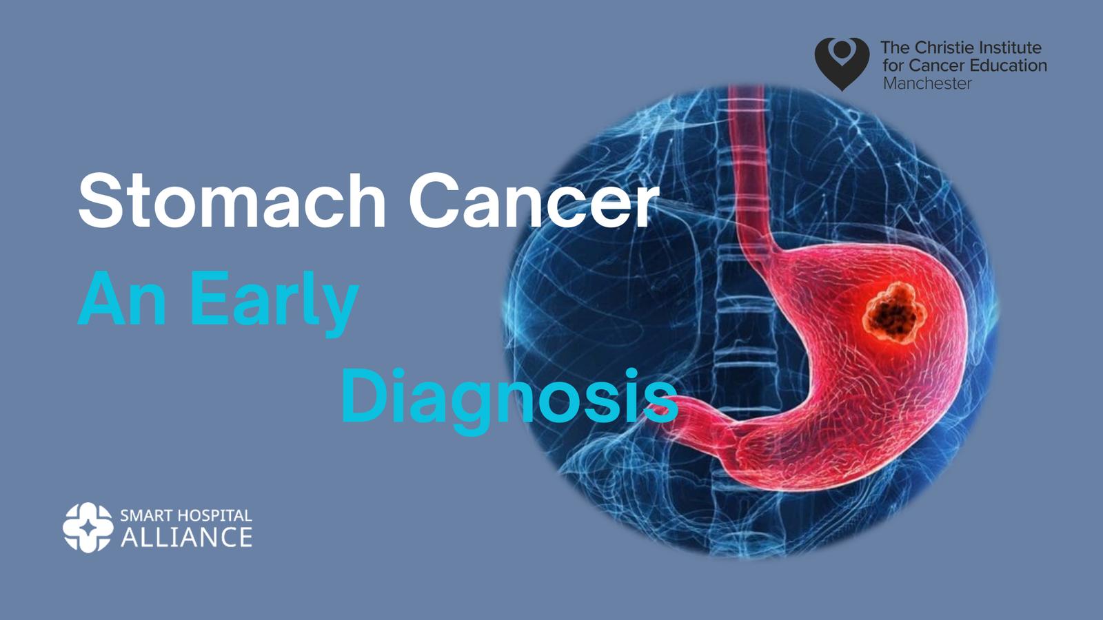 STOMACH CANCER: An Early Diagnosis SHA_09